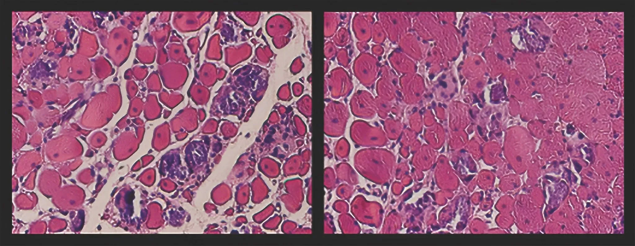 Microscopic images of Cyclic Mechanical Stimulation effect